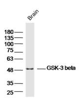 GSK-3 beta antibody