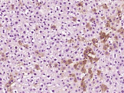 alpha 1 Antitrypsin antibody