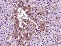 TTR/Prealbumin antibody