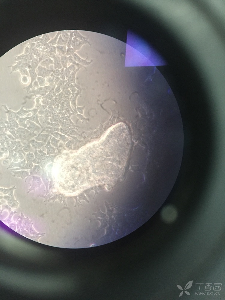 293t细胞上有黄色的团块状的污染,请问只是哪种污染呢?