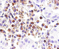 大鼠肺血管平滑肌细胞