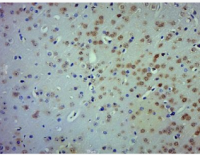 大鼠肺微血管内皮细胞