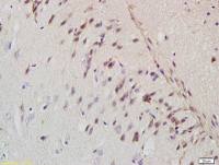 Amyloid Precursor Protein antibody