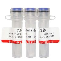 北京现货兔抗人血清白蛋白抗体(BIOTIN标记)折扣价