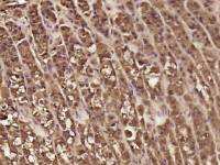 人肺动脉成纤维细胞