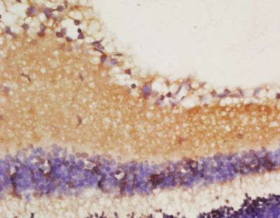 IL-18 antibody