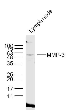 TIMP-1 antibody