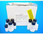 Ferritin light chain (FTL) ELISA Kit, Human产品图