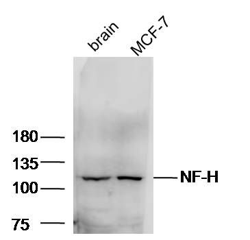 NF-H antibody
