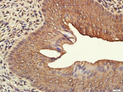Estrogen Receptor alpha antibody