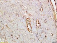 alpha smooth muscle Actin antibody