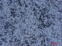 DOK（人口腔粘膜癌前病变细胞）