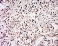 CD93 antibody