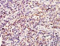 BRCA1 antibody