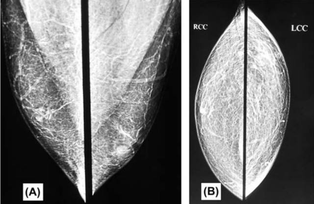 Fig.1.JPG