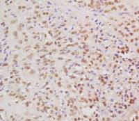 HPV16 E6 protein antibody