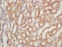 Nephrin antibody