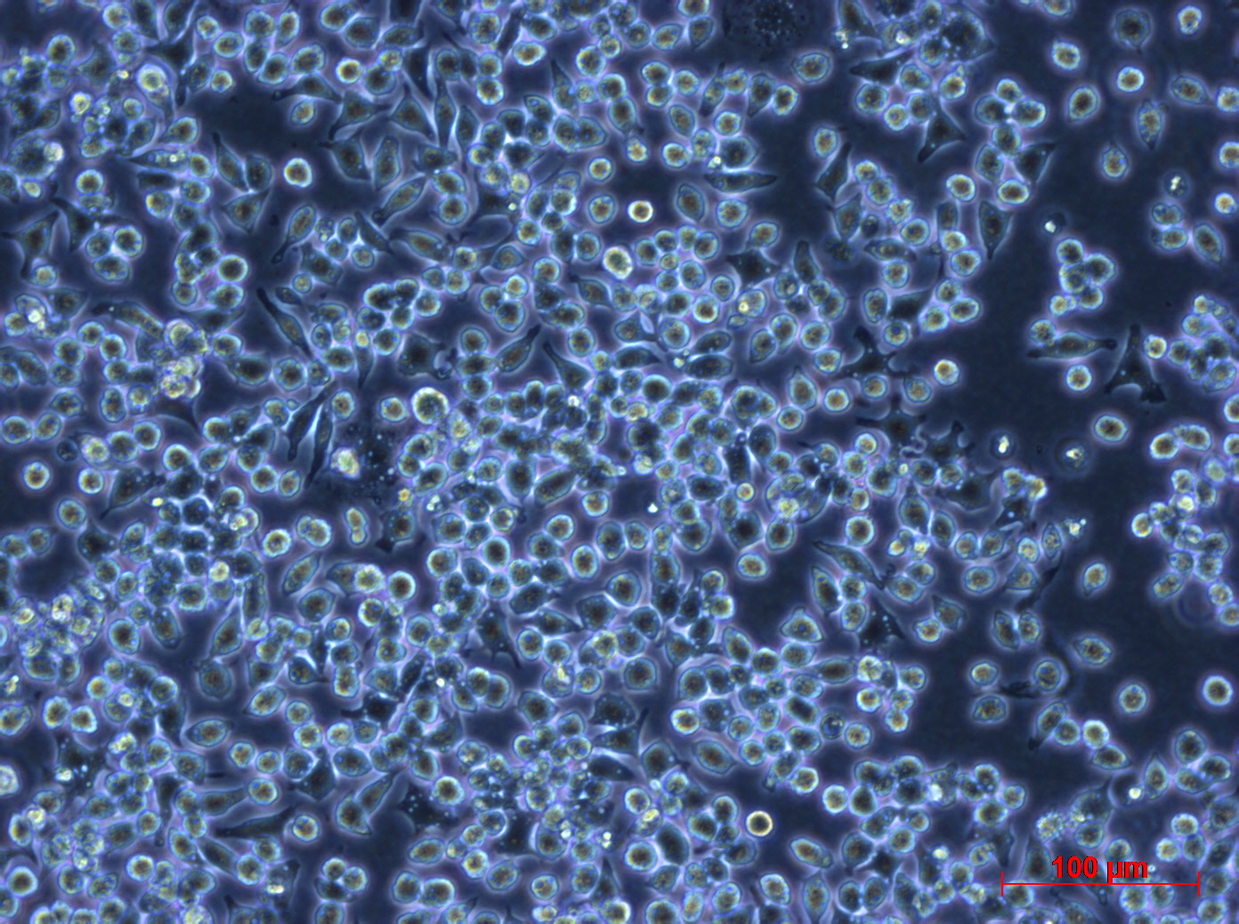 鼠腹水单核细胞瘤J774A.1