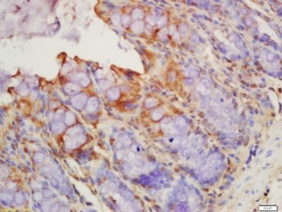 Thrombomodulin antibody