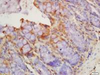 Thrombomodulin antibody