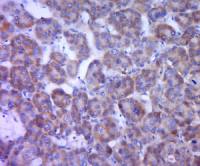 beta Amyloid 1-28 antibody