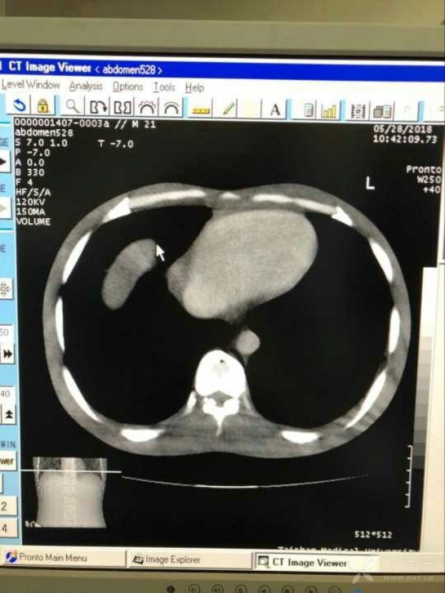 3280630807542704385-16w.jpg!w640