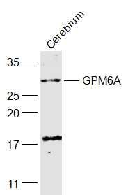 GPM6A antibody