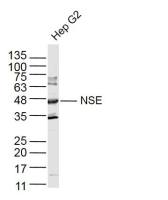 NSE antibody