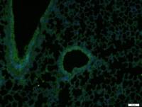 Collagen II antibody