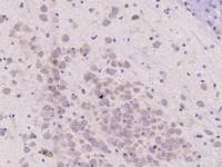 phospho-B-Raf (Ser365) antibody