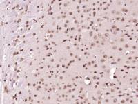 NADPH oxidase 4 antibody