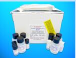 Anti-Endothelial Cell Antibody ELISA Kit (AECA), Human