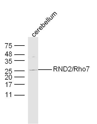 RND2/Rho7 antibody