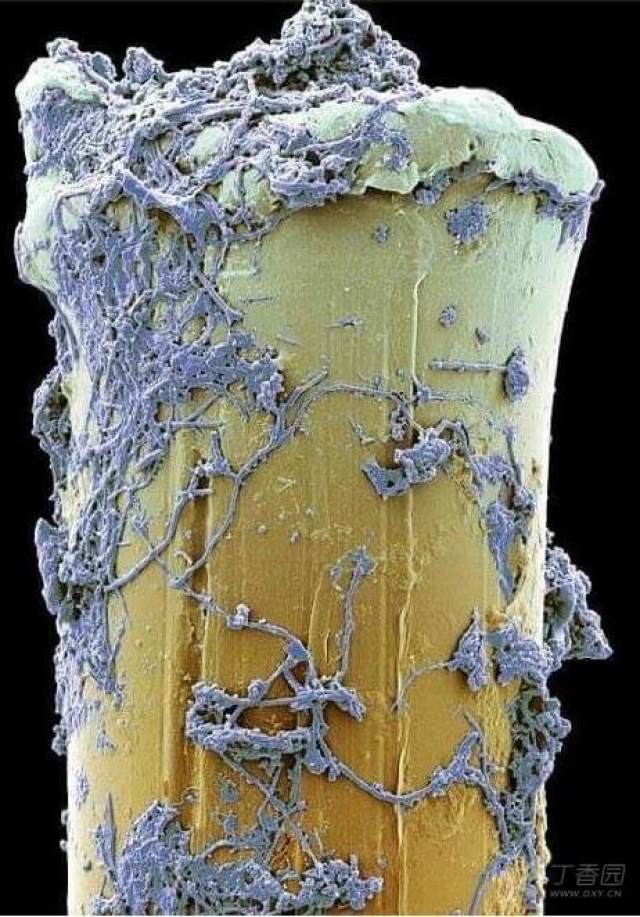 【贴图】显微镜下的神秘世界