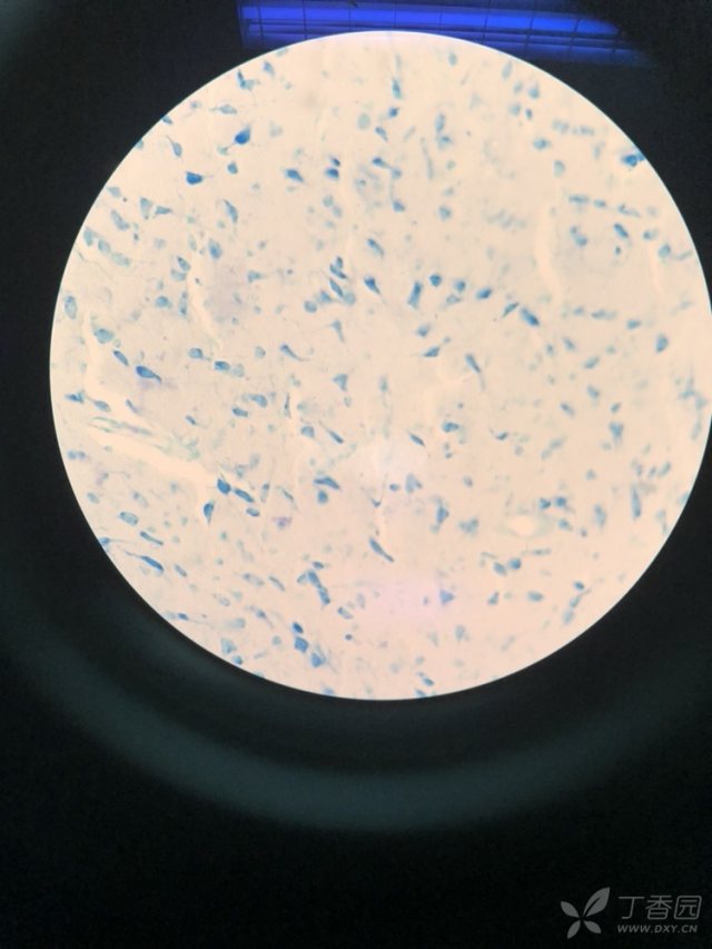 尼氏染色,有人会看吗?帮忙看一下这个怎么样?