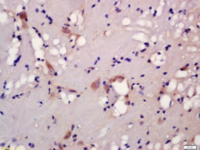 5HT2A Receptor antibody