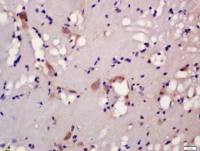 5HT2A Receptor antibody