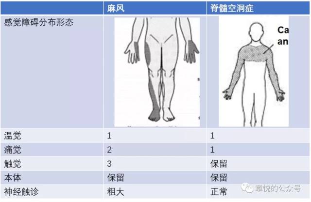 肌电图的疼痛程度图片