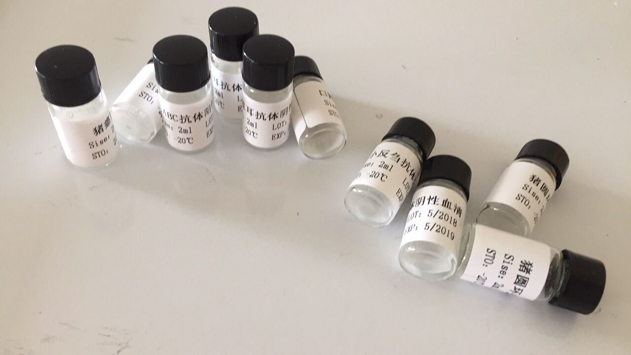 TIM图片20180604163727 agency