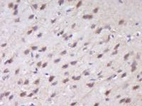 RUSC1 antibody