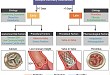 TAVR 术后的迟发冠脉阻塞