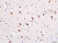 Optineurin antibody