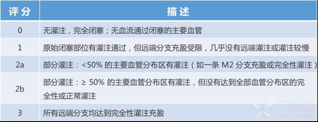 脑梗死怎么治疗最好 如何提高脑梗死的血管内治疗再通率？看看最新共识怎么说