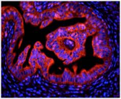 科学大讲堂 | 阿尔茨海默症的分子机制