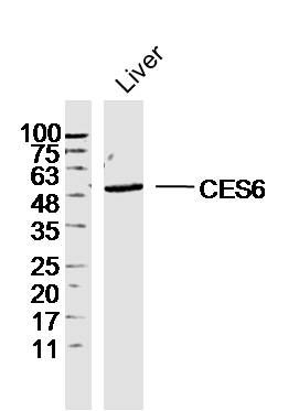 CES6 antibody
