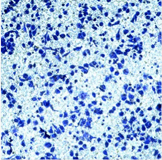 Transwell迁移实验