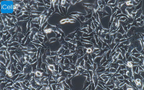 B16 小鼠黑色素瘤细胞/种属鉴定/镜像绮点（Cellverse）