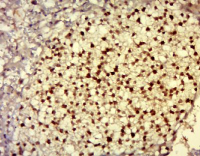 DNAJC21 antibody