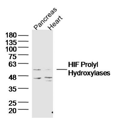 HIF Prolyl Hydroxylases antibody