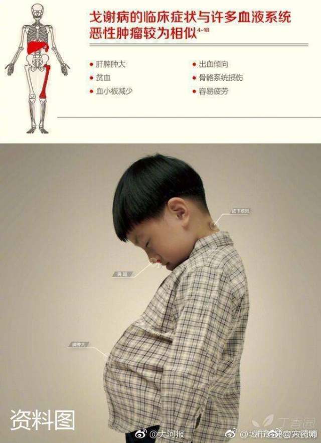 又跑到北京的医院进行检查,最终,小杰被确诊患上了一种名叫戈谢病的罕